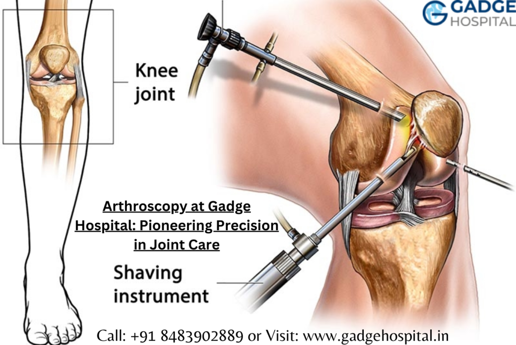 Arthroscopy at Gadge Hospital: Pioneering Precision in Joint Care