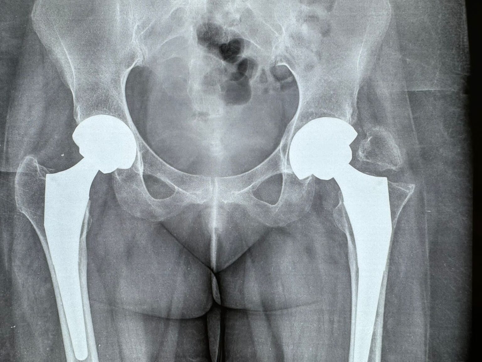 Best Orthopedic Doctor in Nagpur